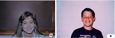 Evidence of an Own-Age Bias in Facial Emotion Recognition for Adolescents With and Without Autism Spectrum Disorder